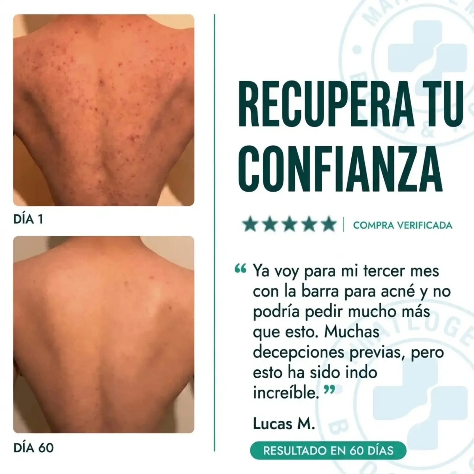 Jabón CLARÉ salicílico y kójico