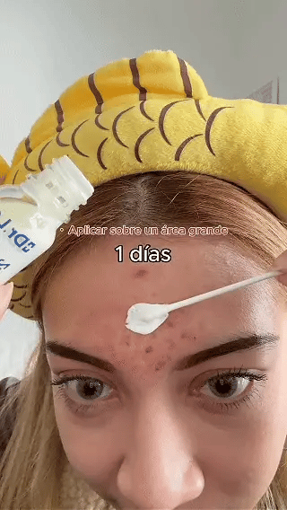 Loción Secante Dr. Leo: Tratamiento Focalizado de Noche